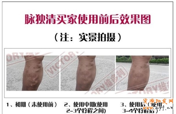 47.【亮钻计划】拒绝理由解析——涉及真人对比的解决方案