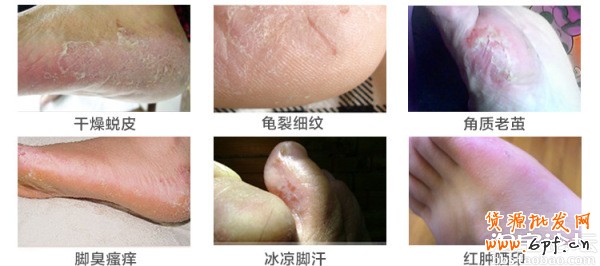 41.【亮钻计划】拒绝理由解析——涉及色情丑陋的解决方案